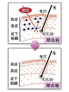 皮膚や毛根へのダメージについて