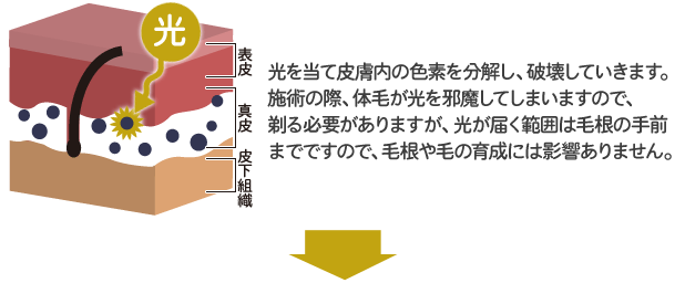 フェニックスLite V2図解1